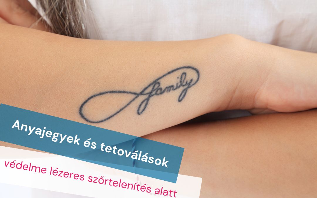 Anyajegyek és tetoválások védelme lézeres szőrtelenítés alatt