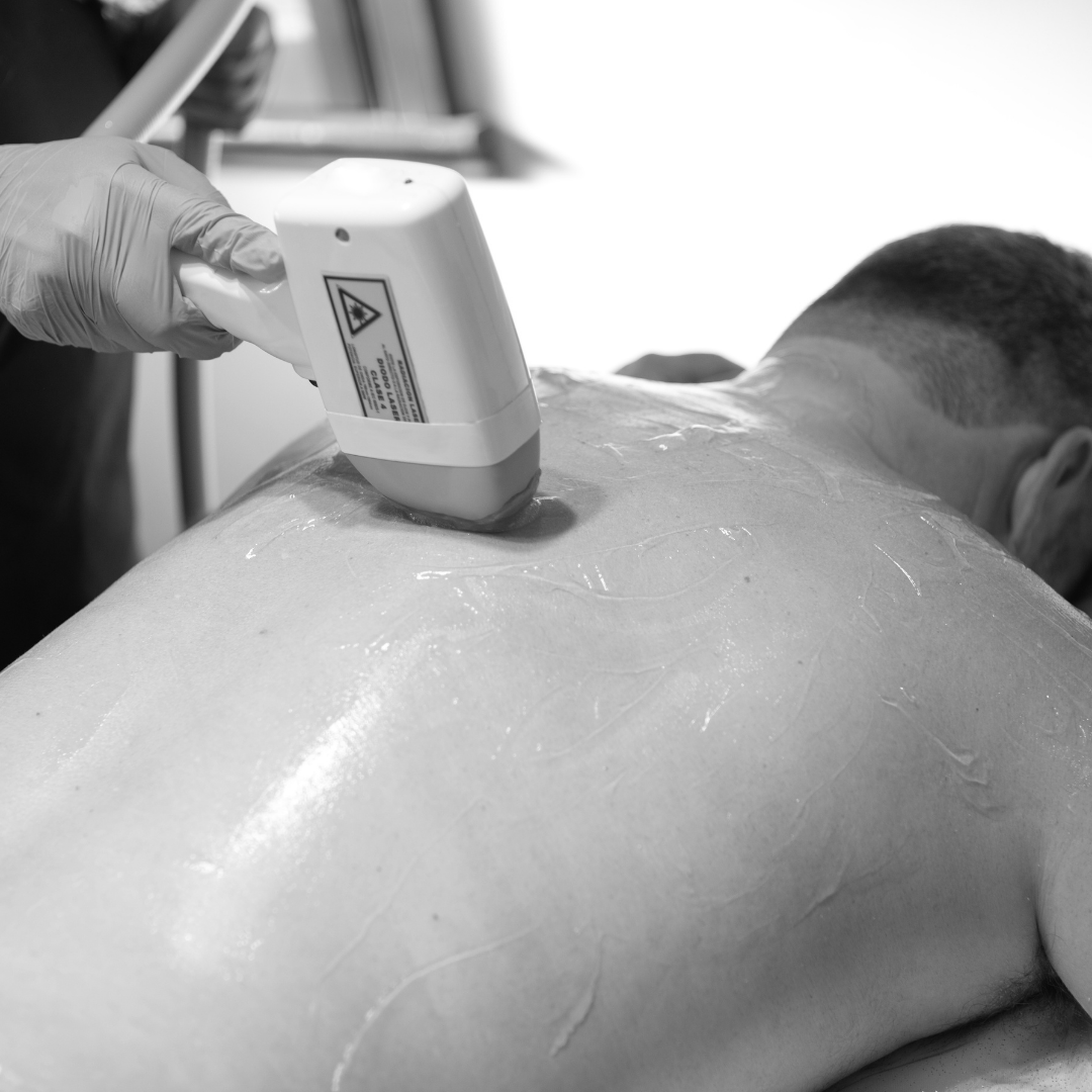 Lézeres szőrtelenítés Budapesten és Székesfehérváron – Absolute Skin szalonban, tartós eredmény