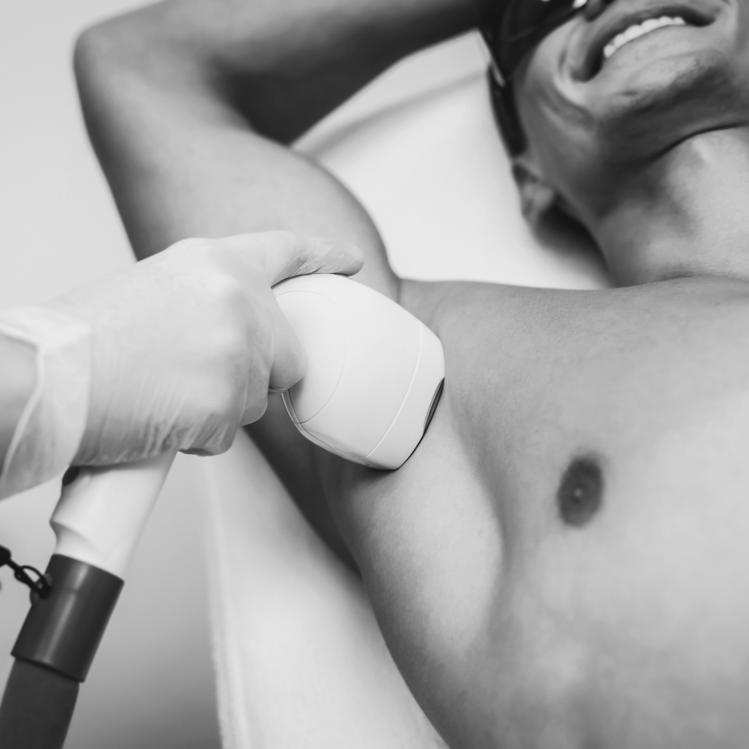 Lézeres szőrtelenítés Budapesten és Székesfehérváron – Absolute Skin szalonban, tartós eredmény